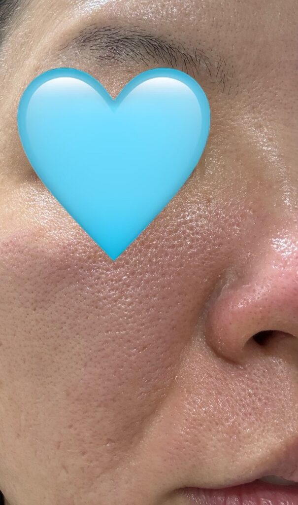 ポテンツァ後の当日夜