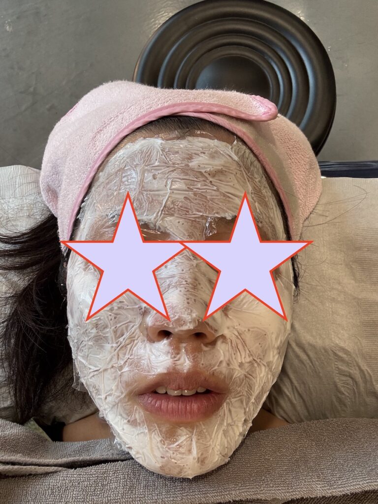 麻酔クリーム後